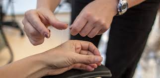 practitioner placing needles on a patient's arm
